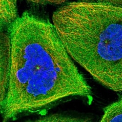 TCHP Antibody, Novus Biologicals 0.1mL; Unlabeled:Antibodies, Polyclonal